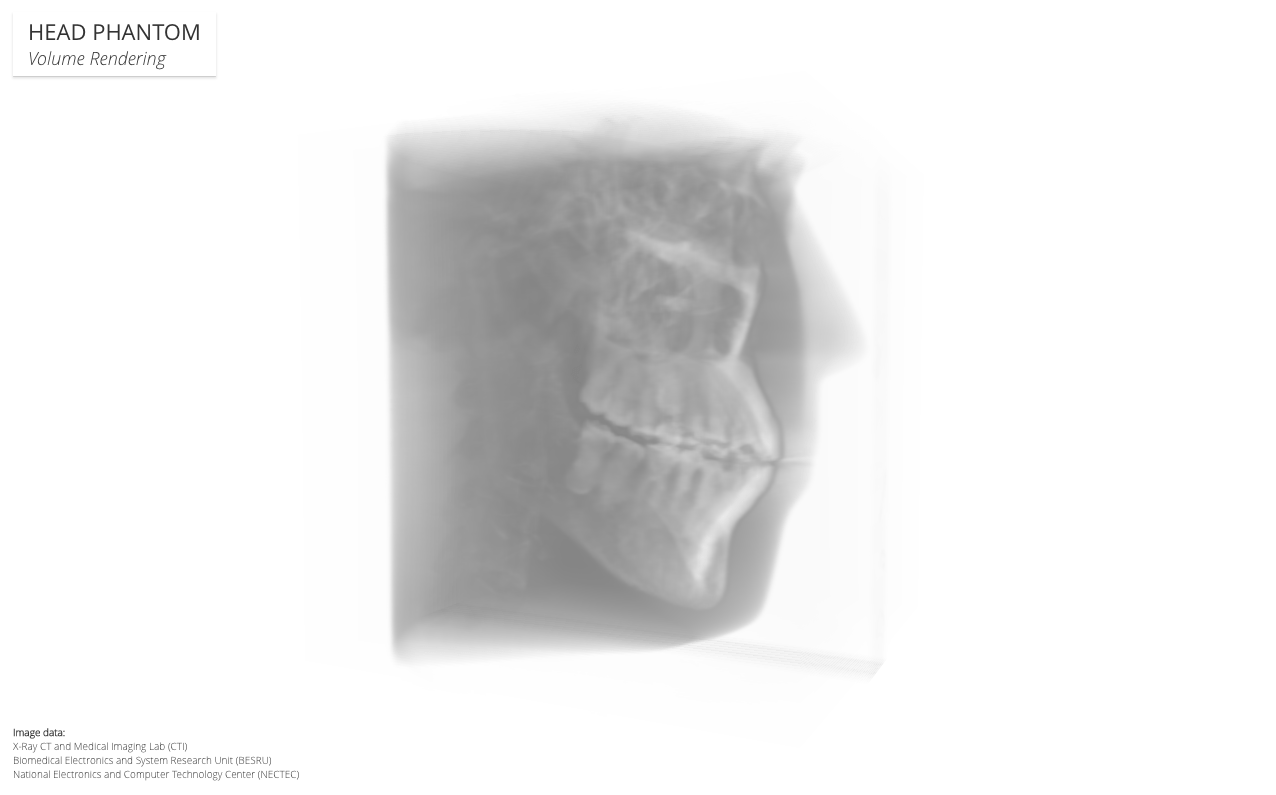 Web3D Medical Image Visualization